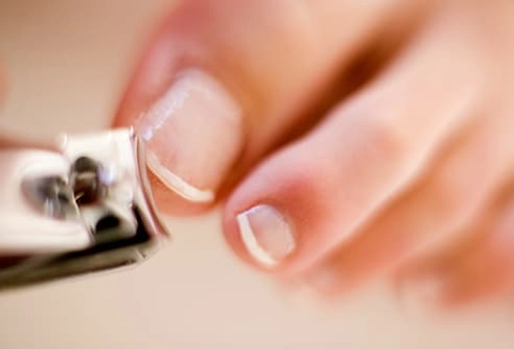 Trimming Toenails the Wrong Way Trimming Toenails the Wrong Way