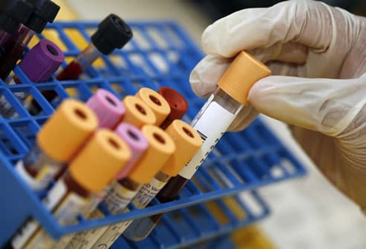 Diagnosing Thyroid Disorders Diagnosing Thyroid Disorders