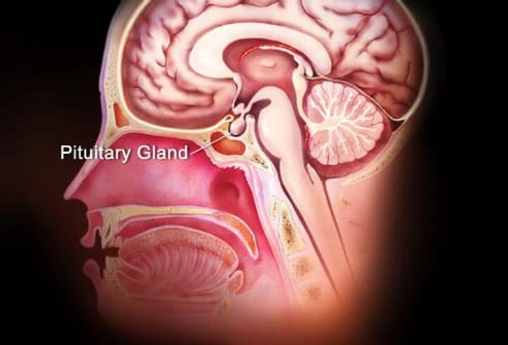 Other Causes of Hypothyroidism