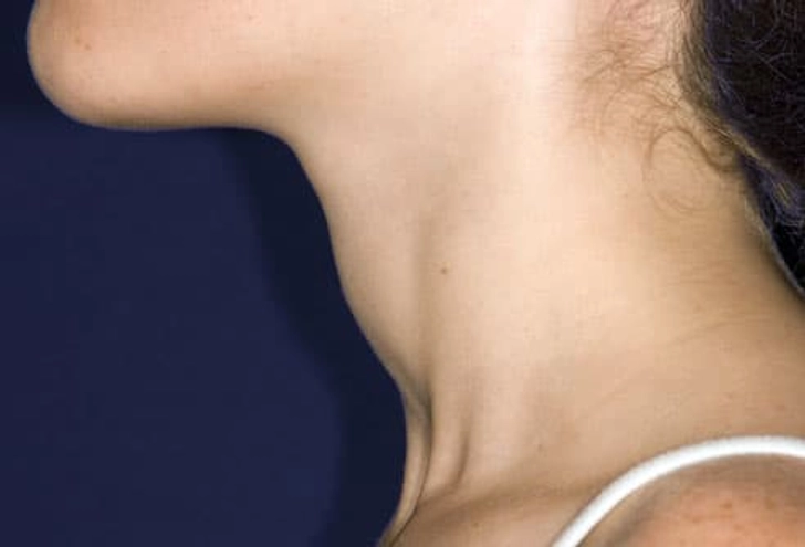 Symptom: Swelling in the Neck