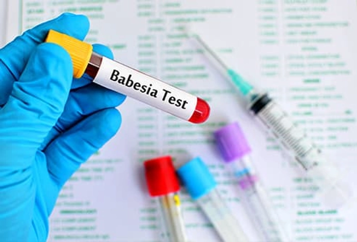 Babesiosis