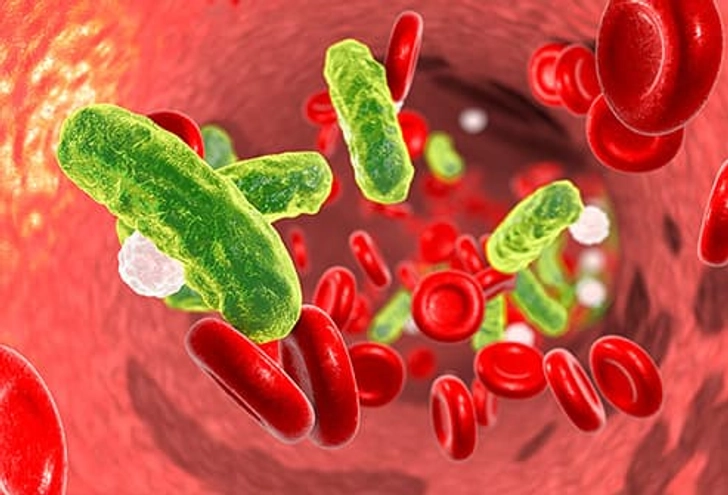 Anaplasmosis