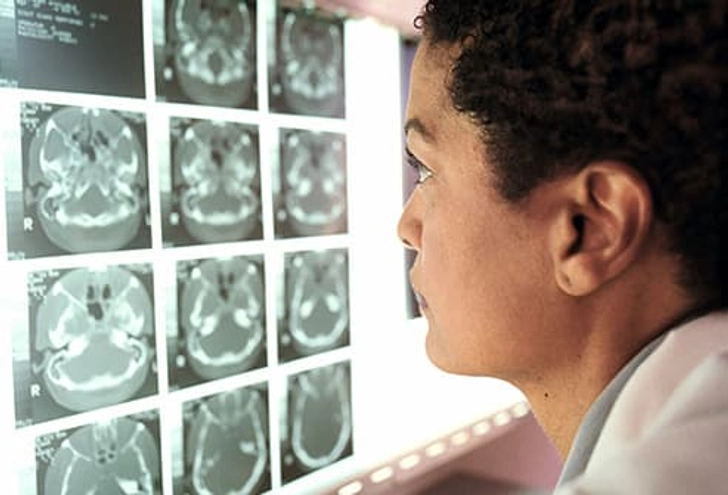 Powassan Diagnosis and Treatment
