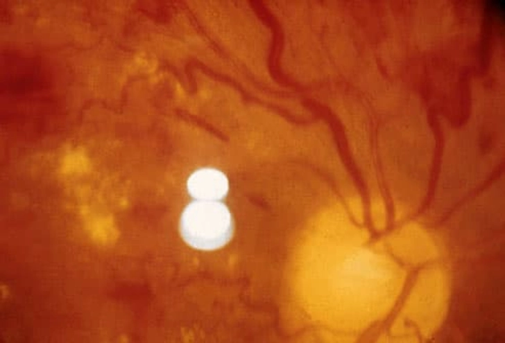 Age-Related Diseases and Vision