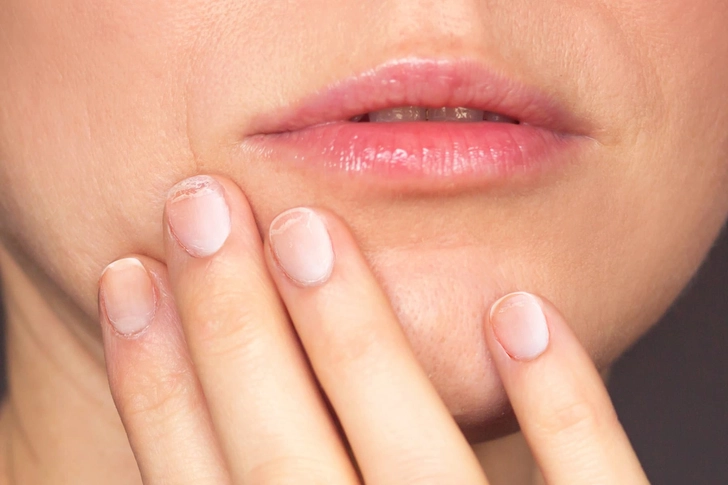 Weak Nails