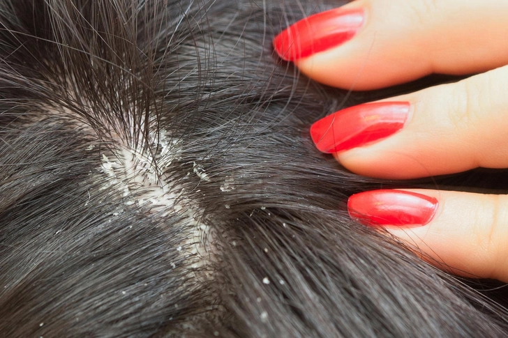 Hair and Scalp