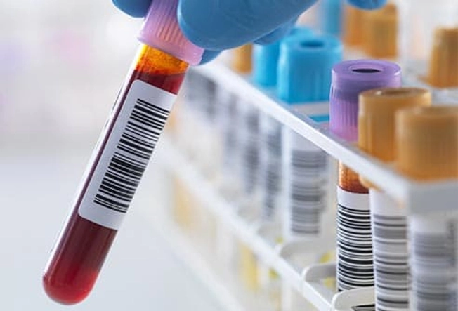 Get Tested Get Tested