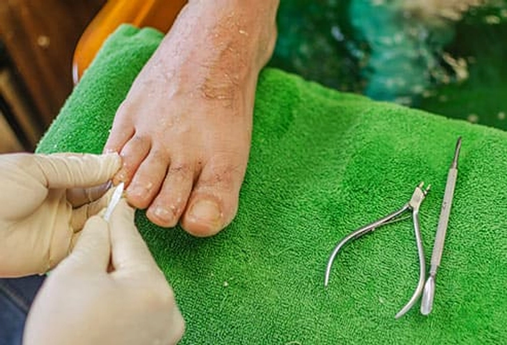 Take Care of Your Toes