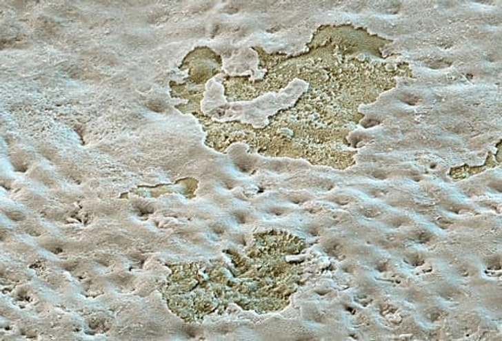 From Erosion to Cavities