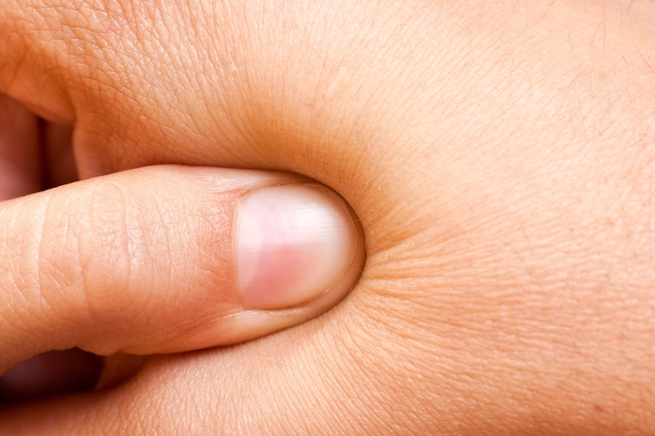 Pinch Your Hand