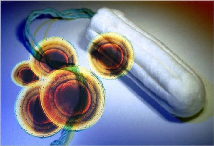 Do Tampons Cause Toxic Shock Syndrome? Do Tampons Cause Toxic Shock Syndrome?