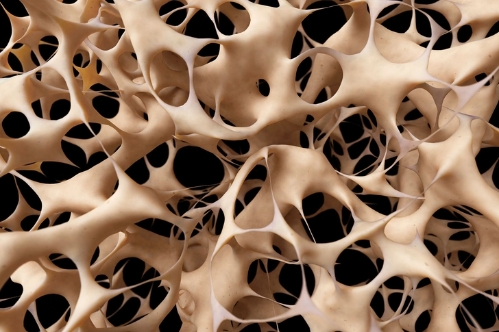 Bone Breaks