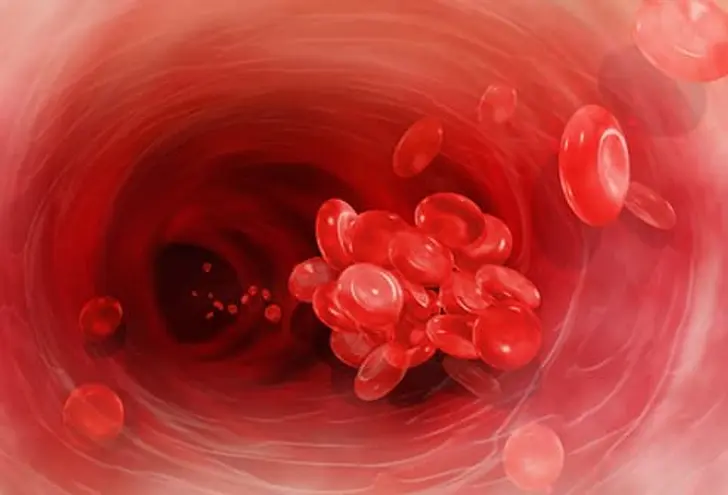 Determining Treatment for Afib Determining Treatment for Afib