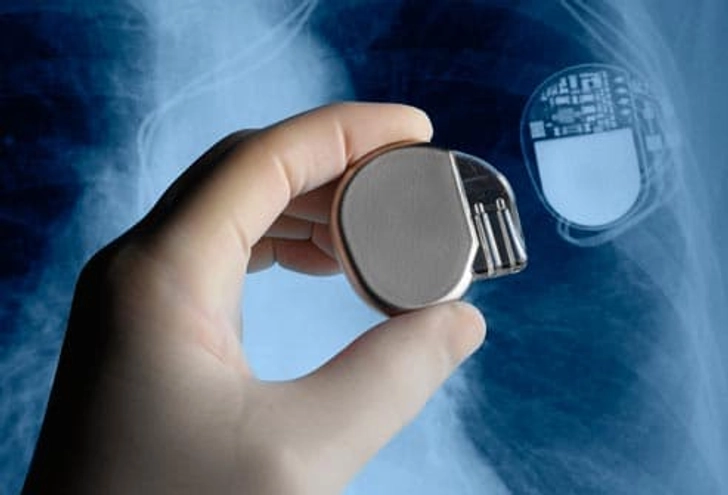 Pacemaker for a Steady Beat Pacemaker for a Steady Beat