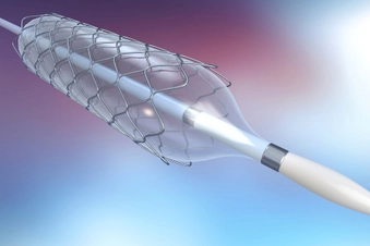 Nonsurgical Heart Procedures Nonsurgical Heart Procedures