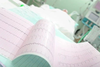 Drugs That Slow Your Heart Rate Drugs That Slow Your Heart Rate
