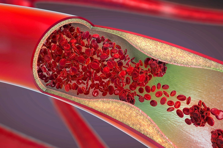 Lowering Cholesterol