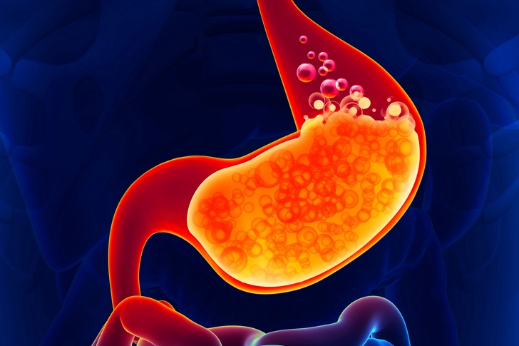 Treating Gas and Indigestion