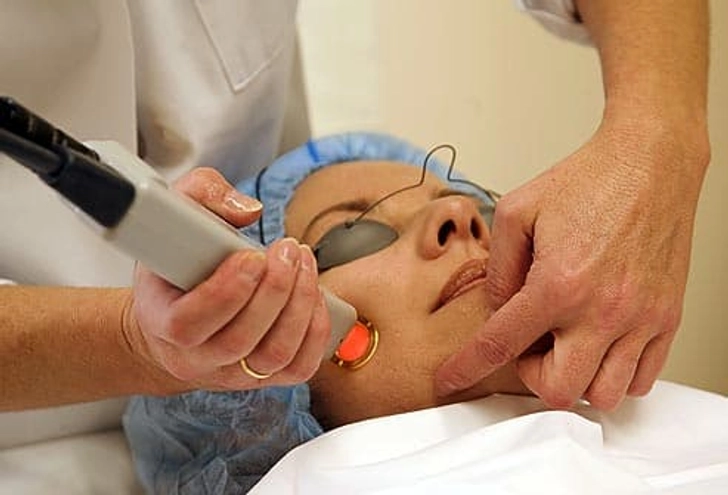 Option: Laser Skin Resurfacing Option: Laser Skin Resurfacing