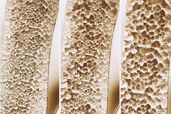 Bone Builder
