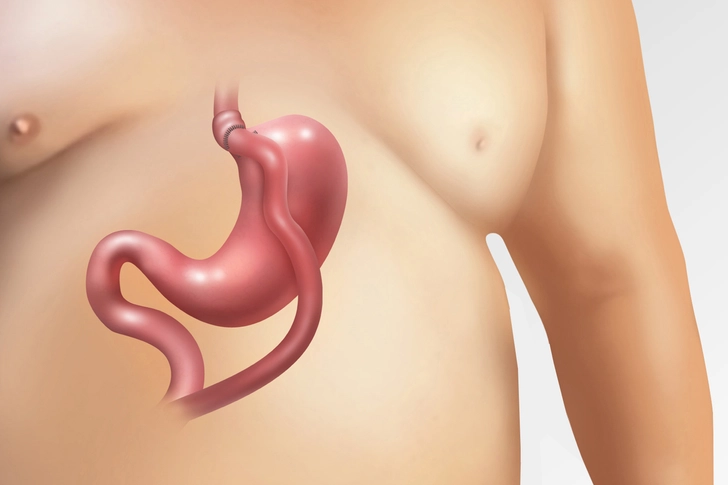 New: Endoscopic Bariatric Therapy