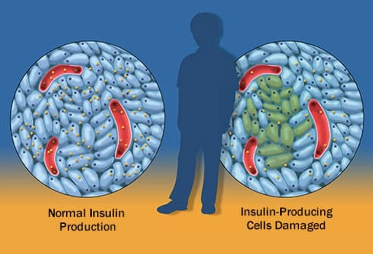 Blood Sugar Challenges