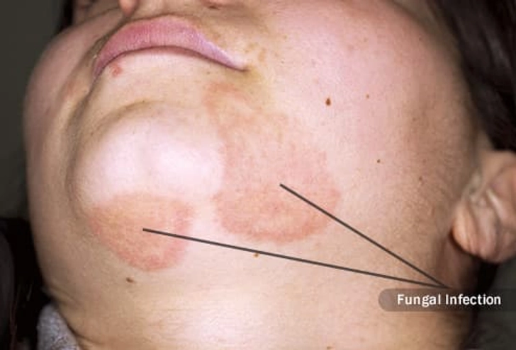 Skin Issues