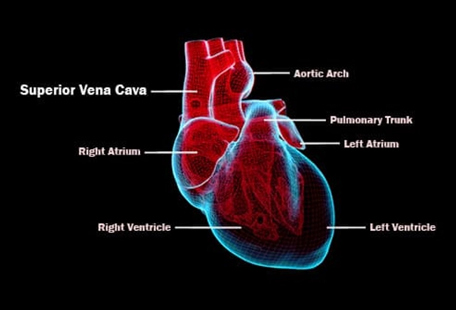 Superior Vena Cava Thrombosis Superior Vena Cava Thrombosis
