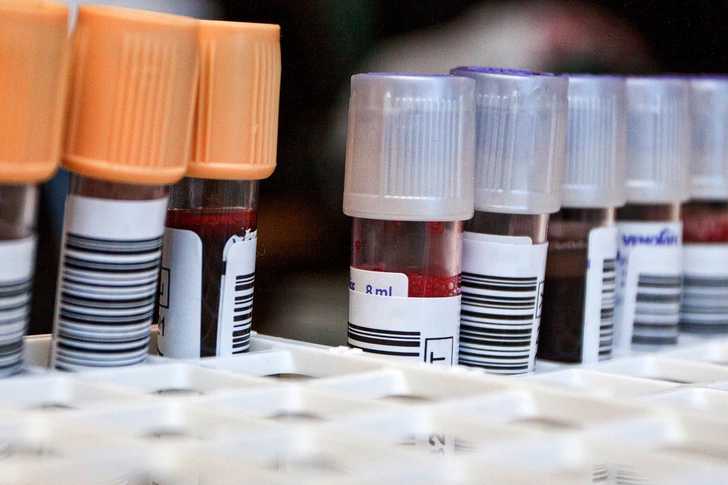Prevention: Regular Checkups