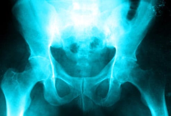 Other Health Problems Other Health Problems