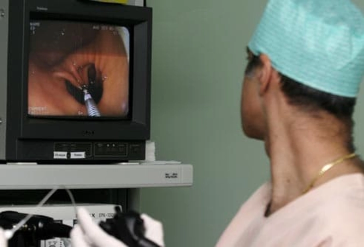 Diagnosing Ulcerative Colitis