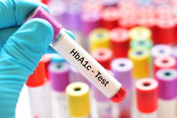 A1c, or Hemoglobin A1c
