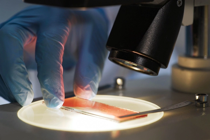 Platelet Count Platelet Count