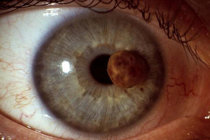 Iris
