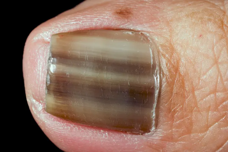 Under a Fingernail Under a Fingernail