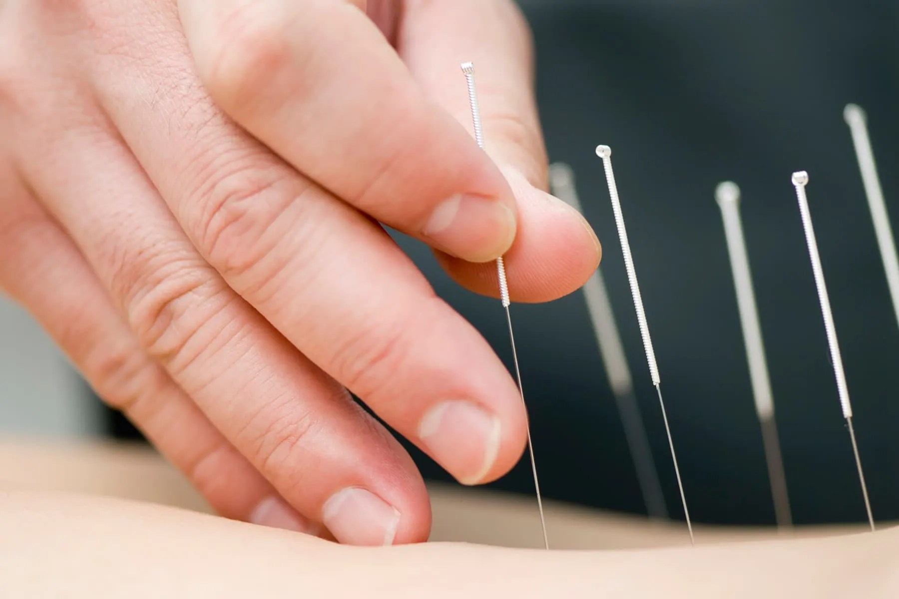 Pain Management