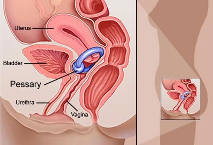 Other Treatments Other Treatments