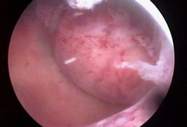 Treatment: Surgery Treatment: Surgery
