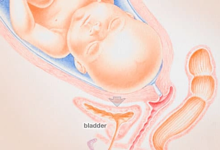UTIs and Pregnancy