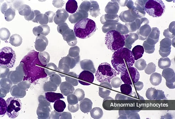 Lymphocytes