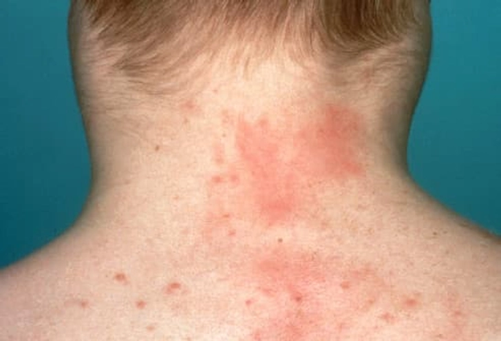 Symptoms Based on Where It Is