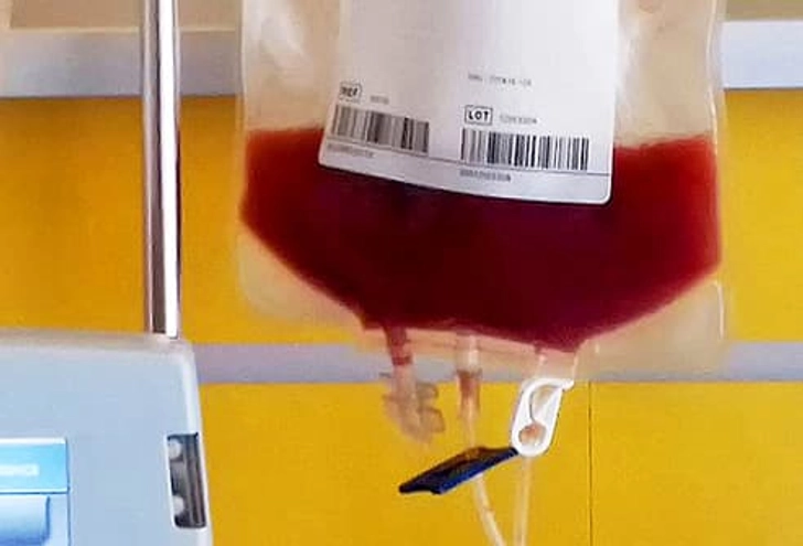Stem Cell Transplant