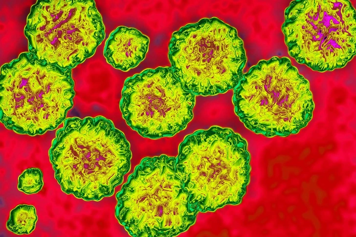 Cause: Hepatitis C Cause: Hepatitis C