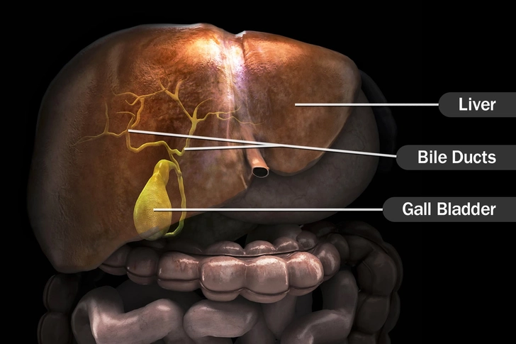 Cause: Bile Duct Problems Cause: Bile Duct Problems