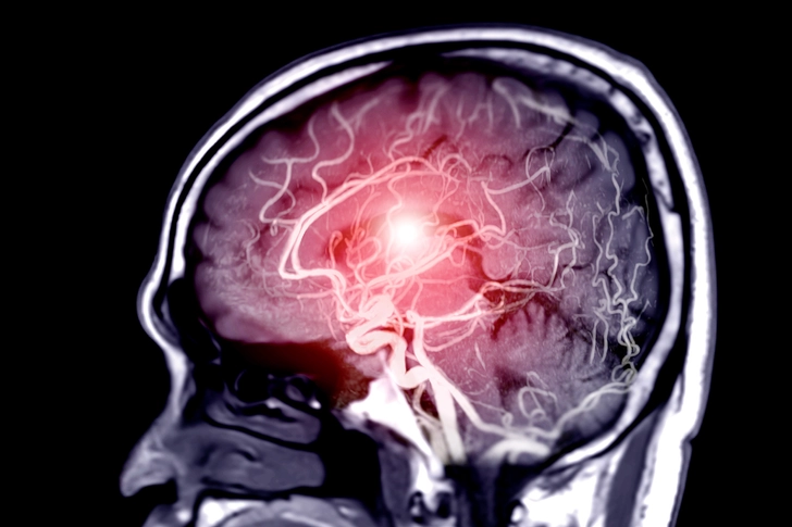 Other Possible Health Problems