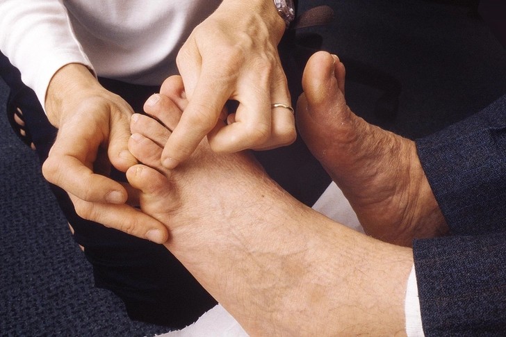 Treatment: Foot Care