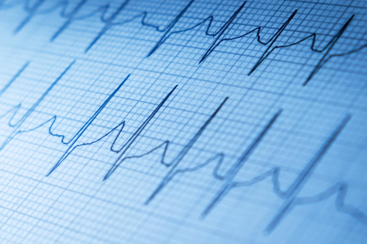What Heart Tests Help Diagnose CAD?