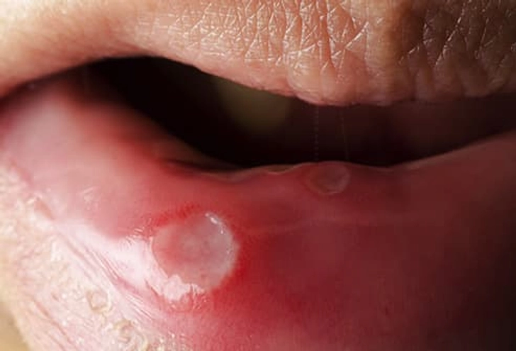 Can It Affect Other Body Parts? Can It Affect Other Body Parts?