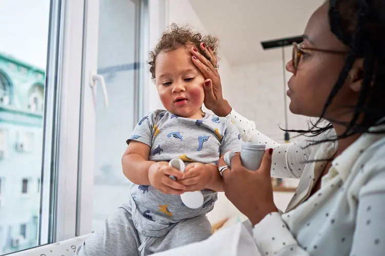 photo of doctor examining toddler with eczema