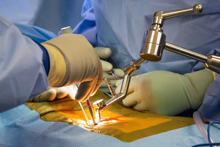 Surgery Surgery